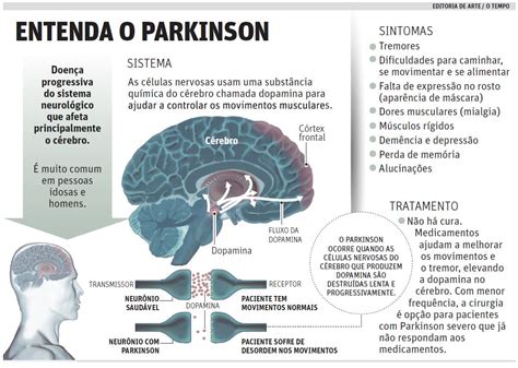 A Doenca De Parkinson S Efeitos Colaterais Da Medicacao Jogo