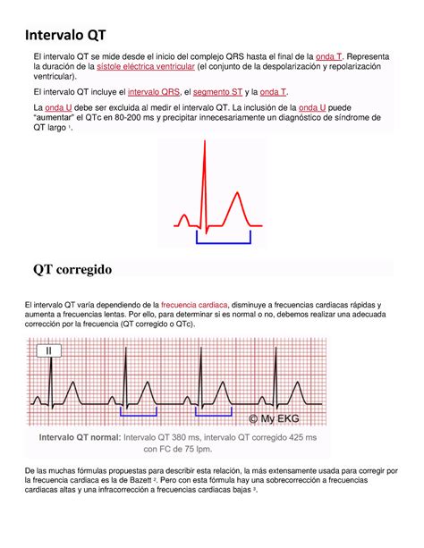 Ranhura De Actualizacao De Qt